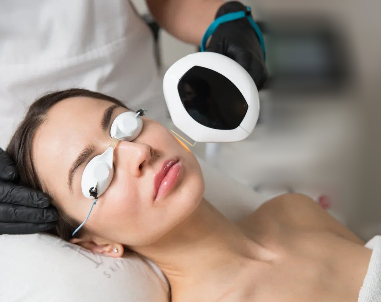 Lumecca IPL facial treatment at Clique Med Spa