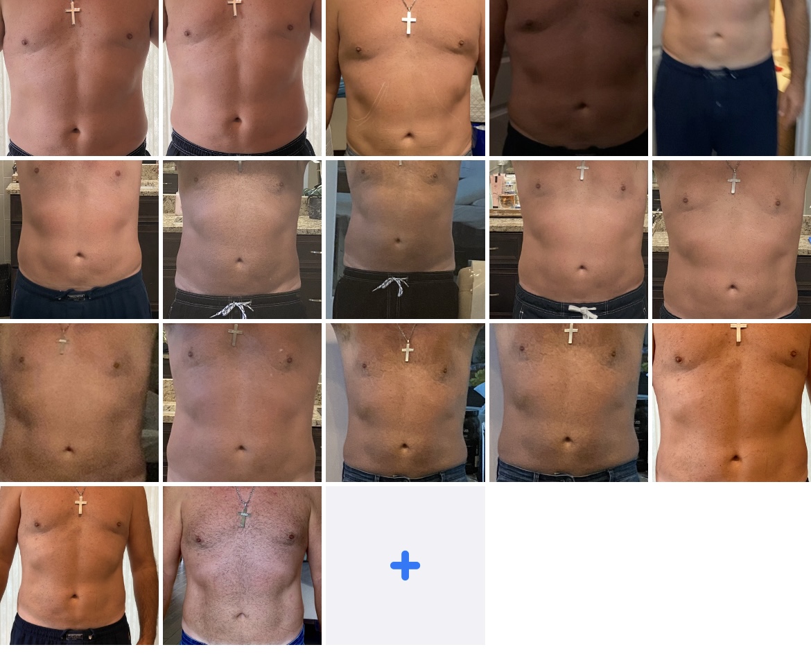 truSculpt flex progression image