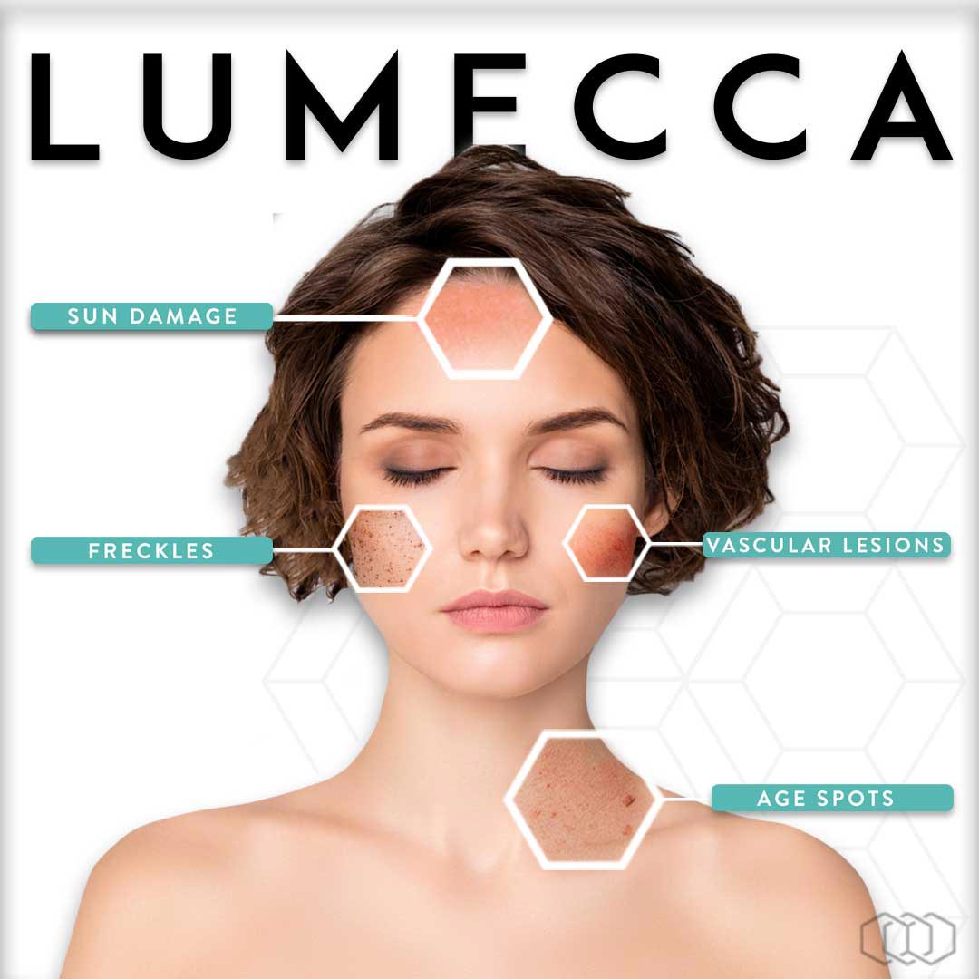 Lumecca IPL treatment close-up