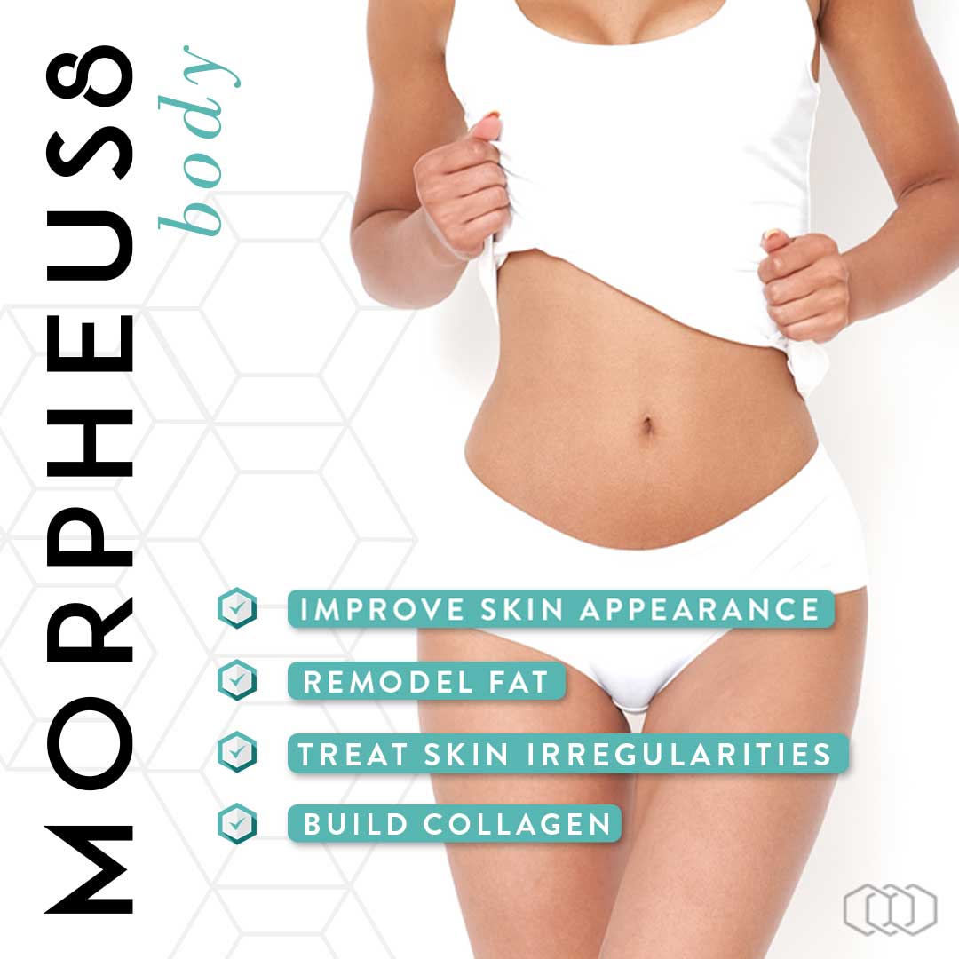 Morpheus8 Body infographic and treatment overview