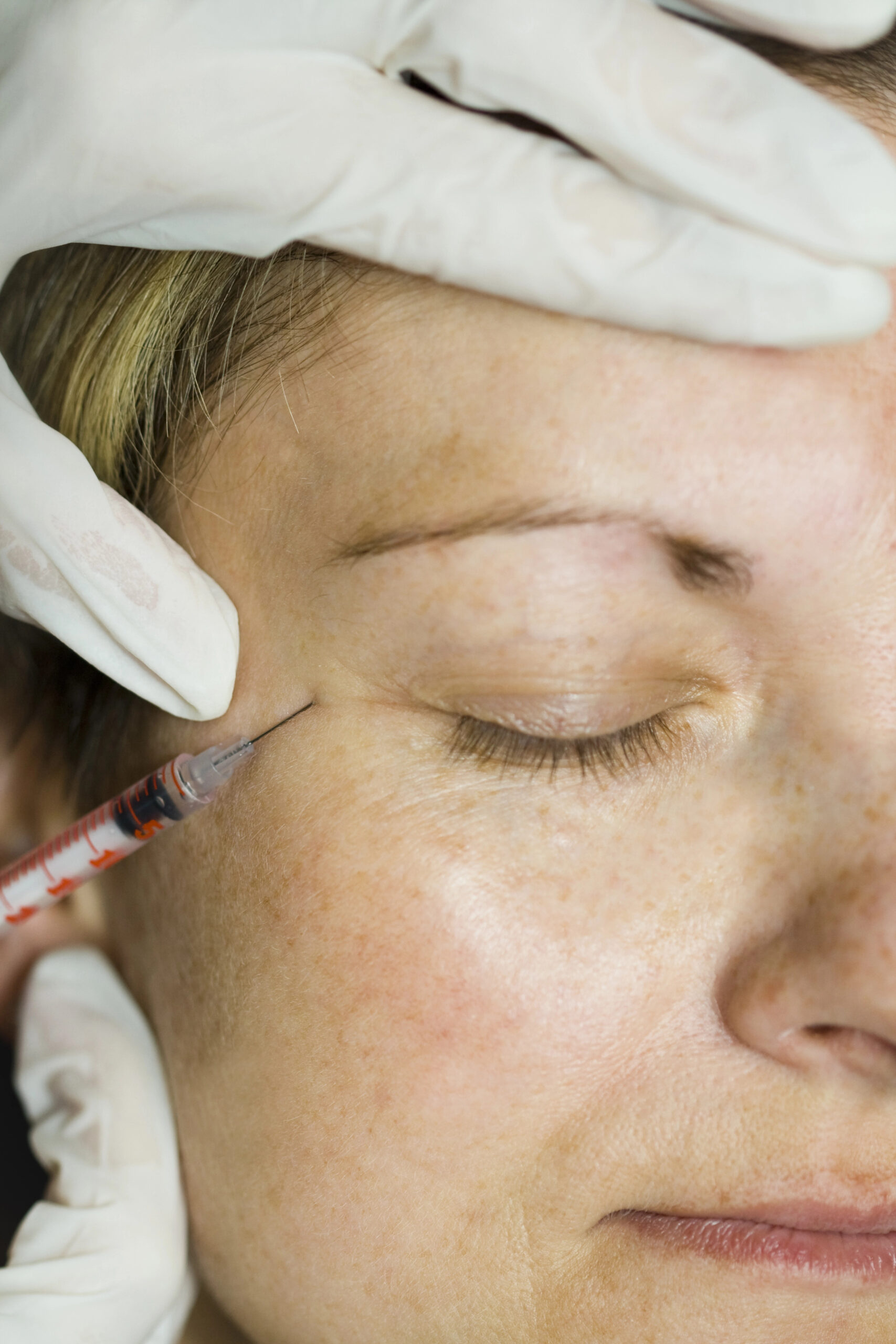 Botox consultation and wrinkle relaxer treatment at Clique Med Spa